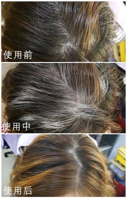 美國甜心傾心推薦，高科技頭發(fā)護理 告別煩惱，擁抱健康秀發(fā)